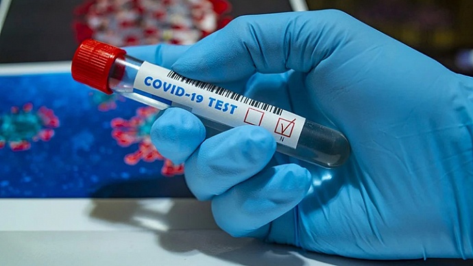 В Україні зафіксували 692 нових випадків COVID-19 за добу