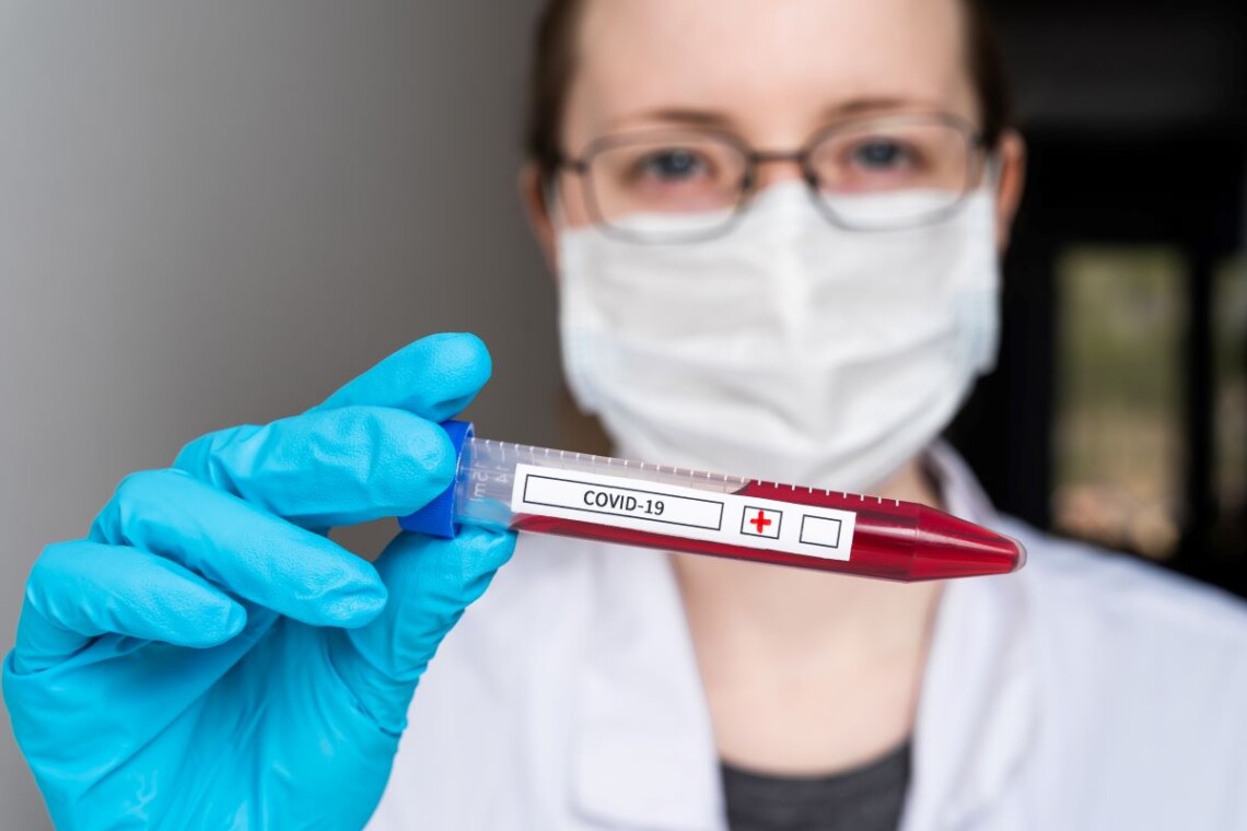 В Україні за добу виявили 19 120 нових підтверджених випадків коронавірусу