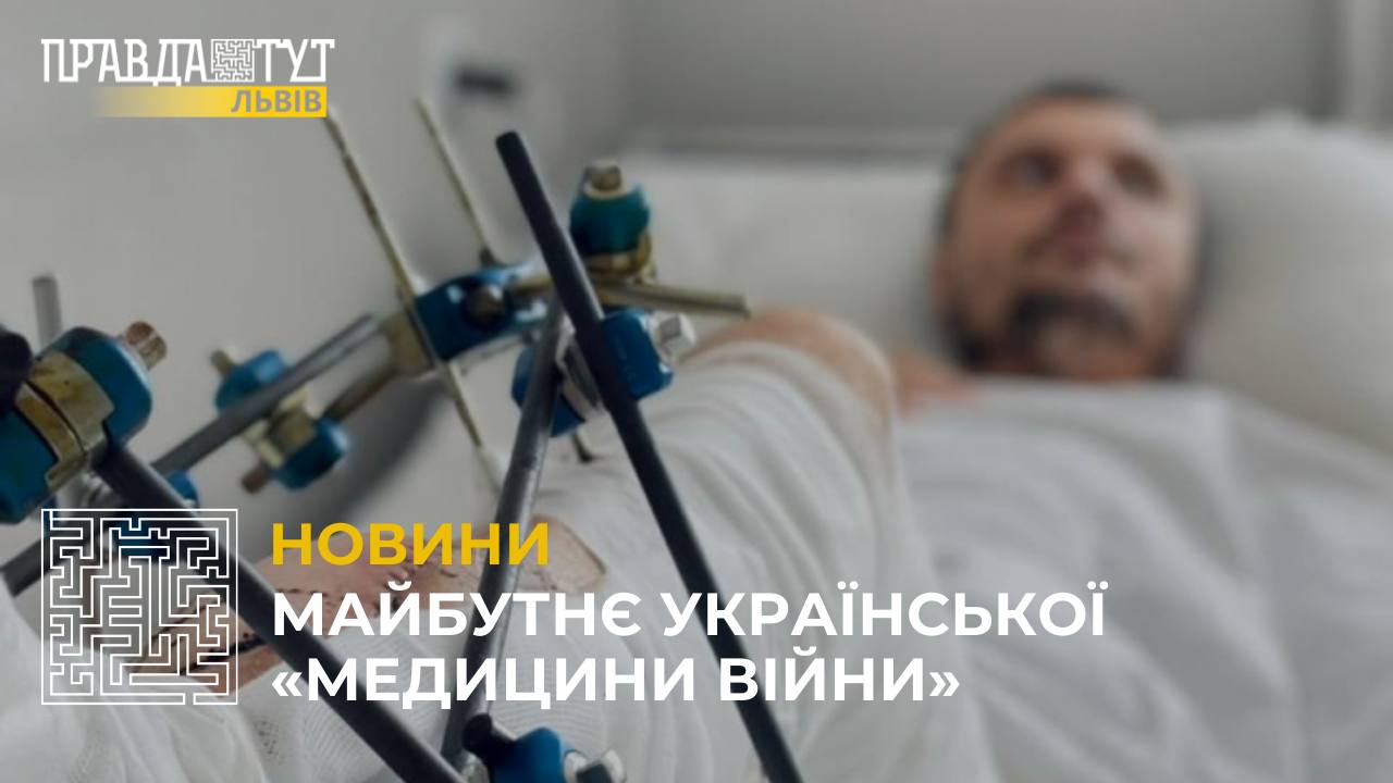 У Львові провели унікальну операцію, щоб врятувати ногу чоловіка від ампутації (відео)