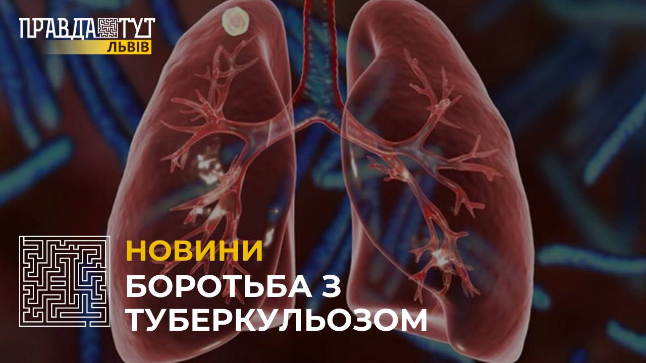 Боротьба з туберкульозом: які симптоми не варто ігнорувати?