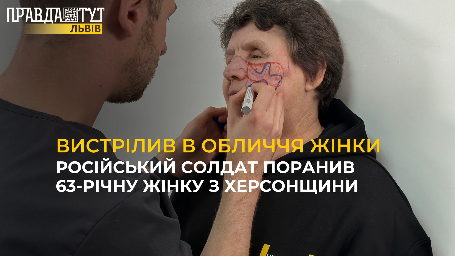 Російський солдат поранив 63-річну жінку з Херсонщини