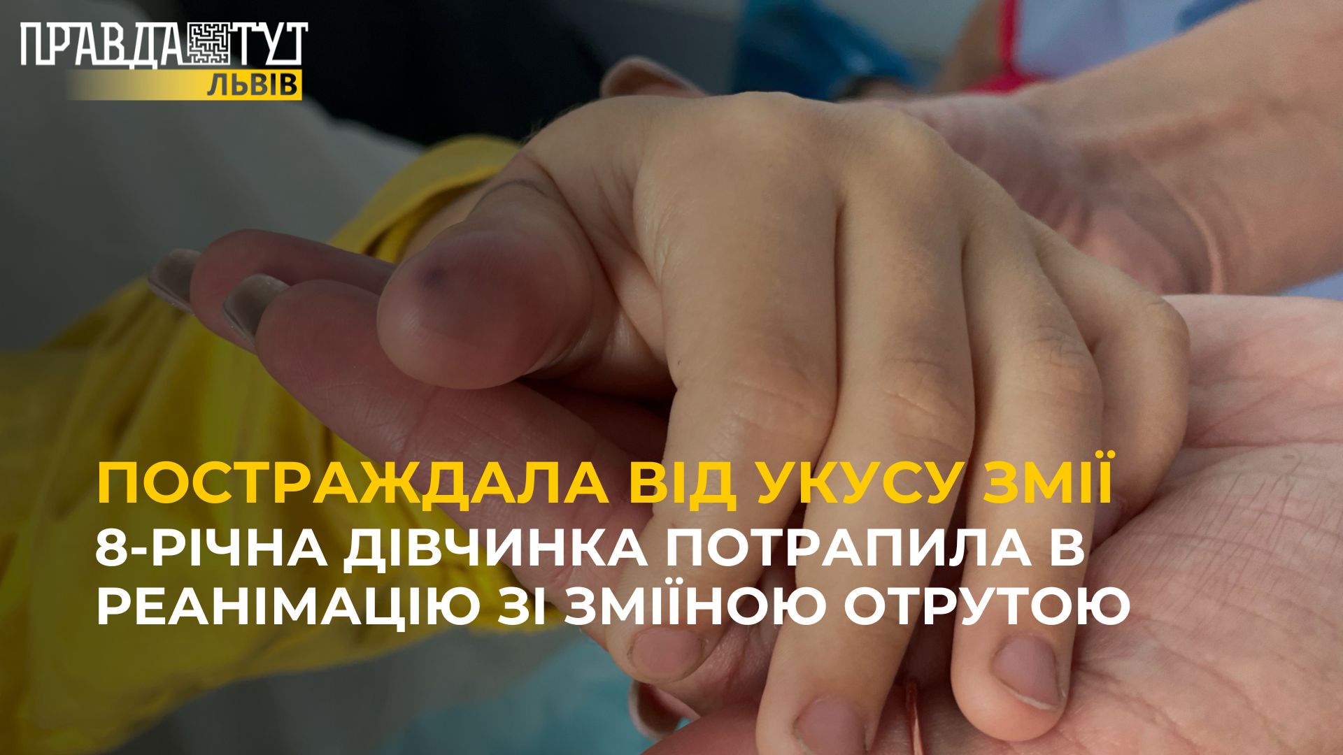 8-річна дівчинка постраждала від укусу змії