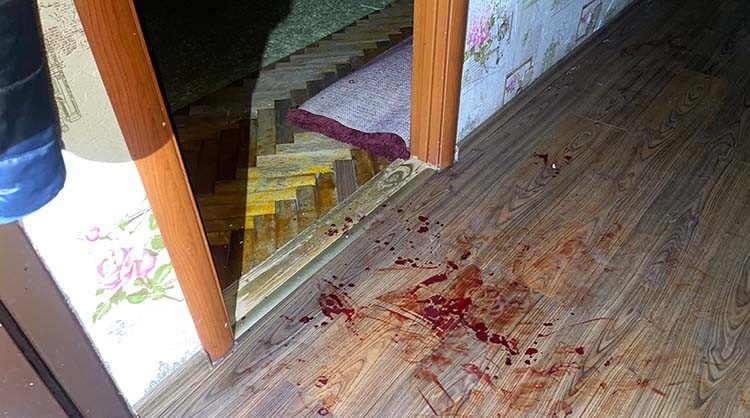 У Тернополі поліцейські затримали чоловіка, який порізав дружину ножем