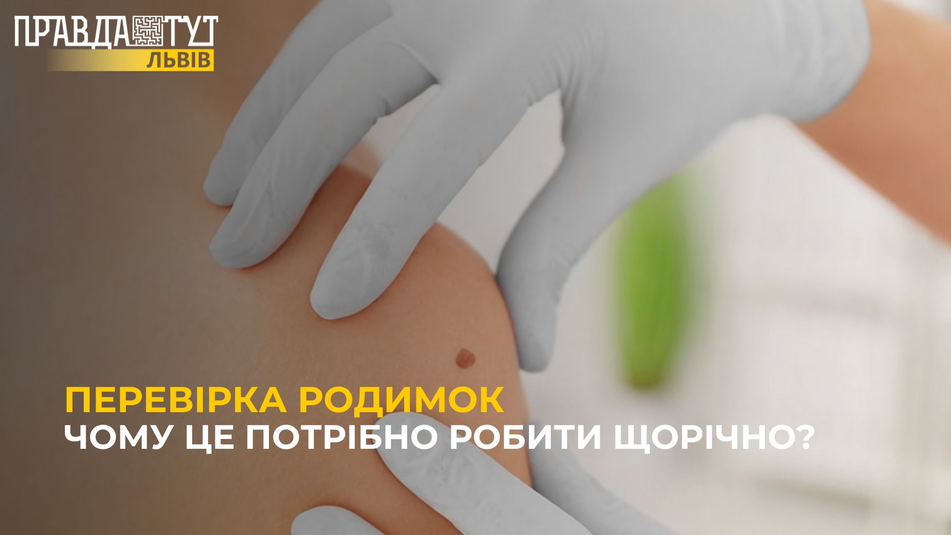 Перевірка родимок: чому це потрібно робити щорічно?