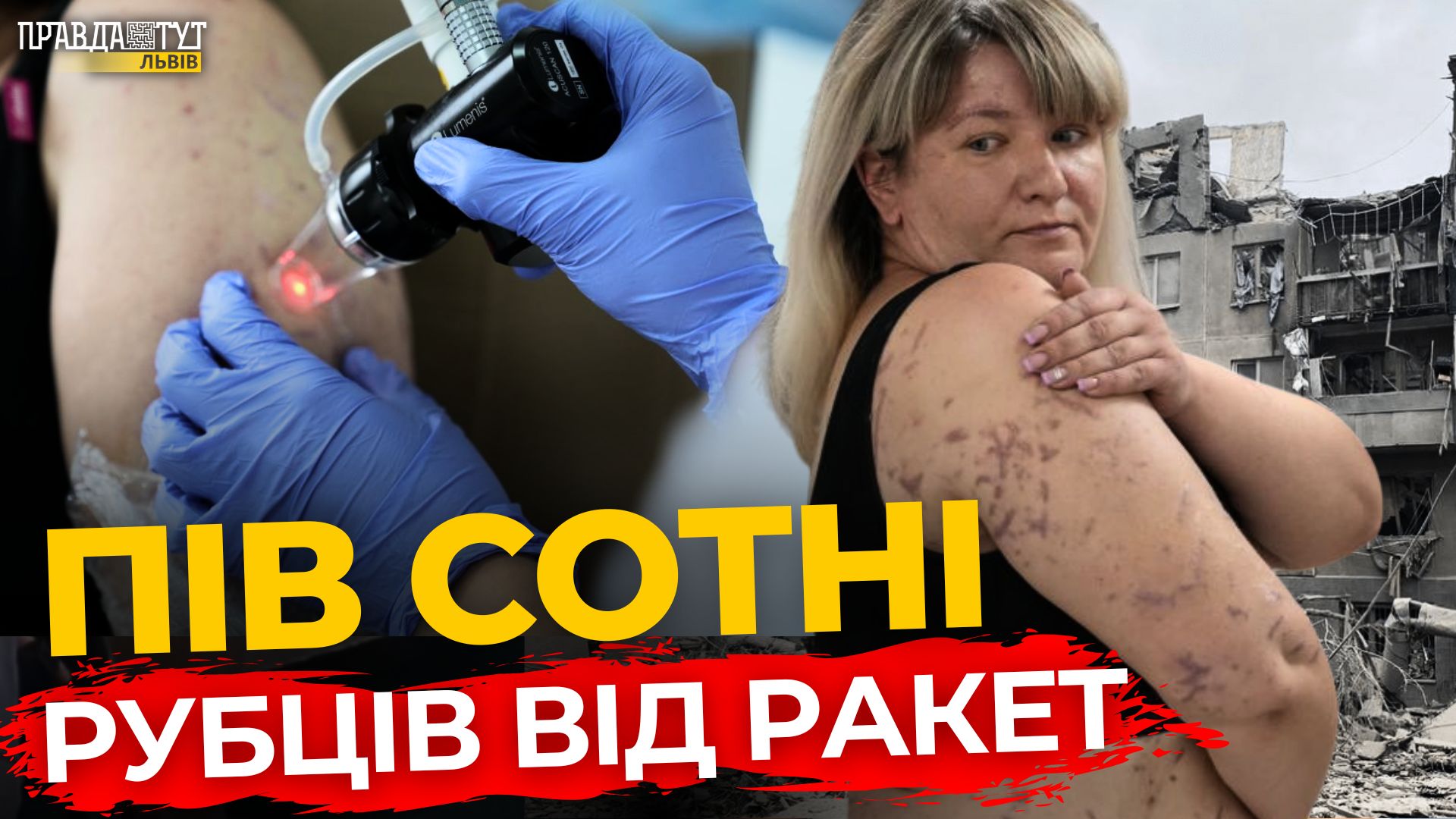 Як у Львові рятують жінку зі Словʼянська | ПравдаТУТ Львів