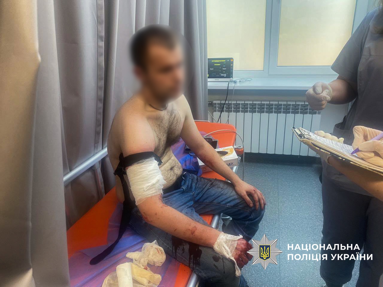 У Запоріжжі під час обшуків чоловік напав на поліцейських: нападник загинув