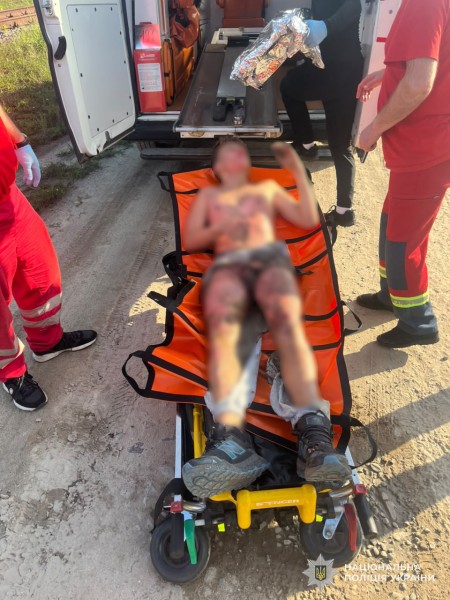 У Львові 13-річного хлопця уразило струмом під час спроби зробити селфі на вагоні