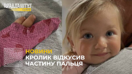 Кролик відкусив частинку пальця 1,5-річній дівчинці з Львівщини (відео)