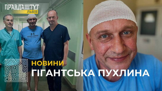 Медики Львова видалили чоловіку, який готувався їхати на фронт, гігантську пухлину (відео)