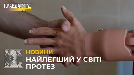 У Львові пацієнту встановили найлегший у світі протез (відео)