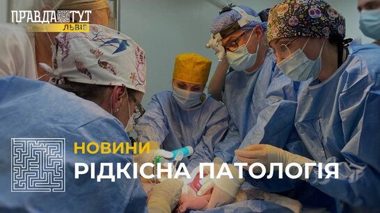 На заході України вперше прооперували немовля, яке народилося з кишківником назовні (відео)