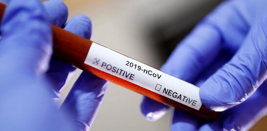 В Україні зростає кількість госпіталізацій через COVID-19