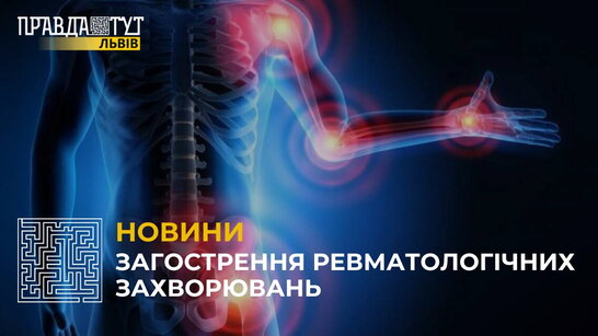 Загострення ревматологічних захворювань: хто в зоні ризику? (відео)