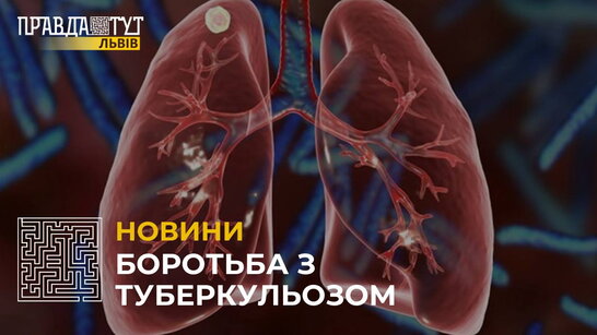 Боротьба з туберкульозом: які симптоми не варто ігнорувати?