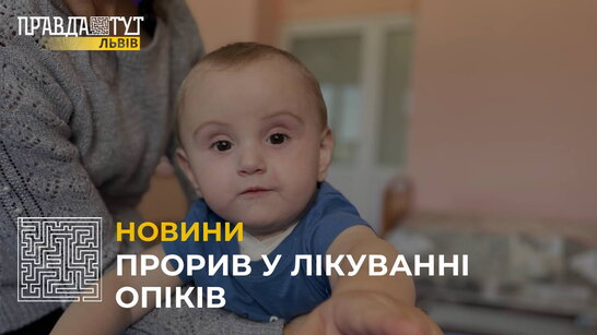 В Україні однорічній дитині вперше пересадили шкіру від посмертного донора