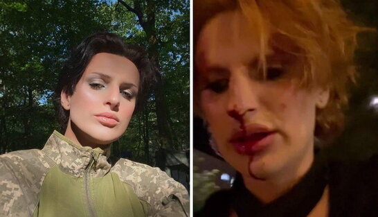 Побиття трансгендерної військової у Львові: нападник отримав підозру