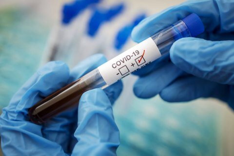 В Україні не зареєстровано випадків нового варіанту коронавірусу під назвою "Пірола" – Кузін