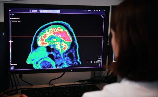 На Житомирщині почали проводити діагностику мозку за допомогою штучного інтелекту