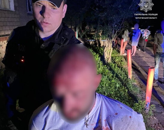 У Чернігові чоловік з ножем накинувся на групу людей