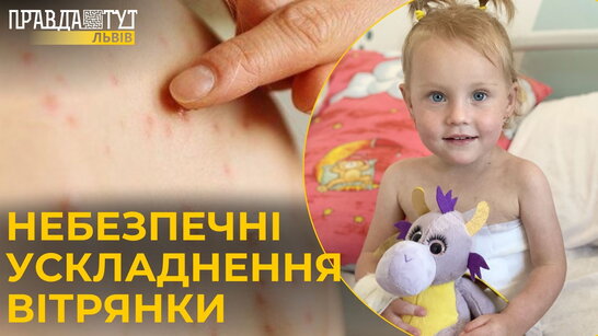 Небезпечні ускладнення вітрянки