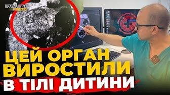 У Львові хірурги виростили частину печінки в організмі немовляти | ПравдаТУТ Львів