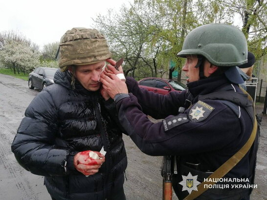 На Дніпропетровщині чоловік кинув гранати в поліцейських під час затримання: п’ятеро поранених