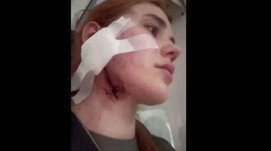 МЗС закликає польських правоохоронців негайно відреагувати на побиття українців у Вроцлаві