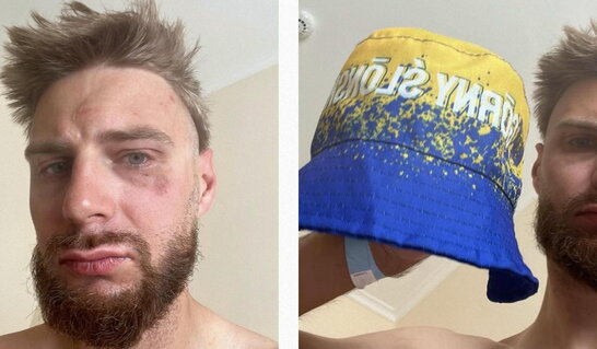 У Чехії поляка побили через панамку в кольорах прапора України