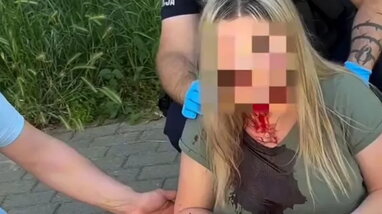 У Польщі знову невідомий жорстоко побив українку палицею