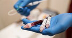 МОЗ: в Україні від коронавірусу за минулу добу померли 58 людей
