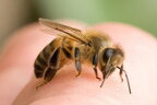 Алергія на комах: в деяких випадках укуси комах бувають смертельними (відео)