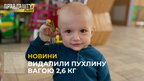У Львові однорічному хлопчику видалили пухлину вагою майже 3 кілограми