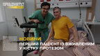 Перший в Україні пацієнт із вживленими в кістку протезами почав ходити