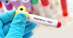На Тернопільщині підтвердили випадок захворювання на гепатит А