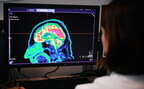На Житомирщині почали проводити діагностику мозку за допомогою штучного інтелекту