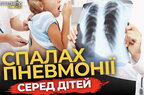 Пневмонія вражає дітей на Львівщині: 80% дітей у «Охматдиті» госпіталізовані з цим діагнозом