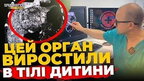 У Львові хірурги виростили частину печінки в організмі немовляти | ПравдаТУТ Львів