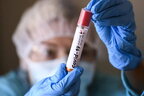 Японські медики виявили нову групу ризику серед хворих на коронавірус