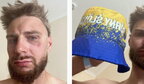 У Чехії поляка побили через панамку в кольорах прапора України